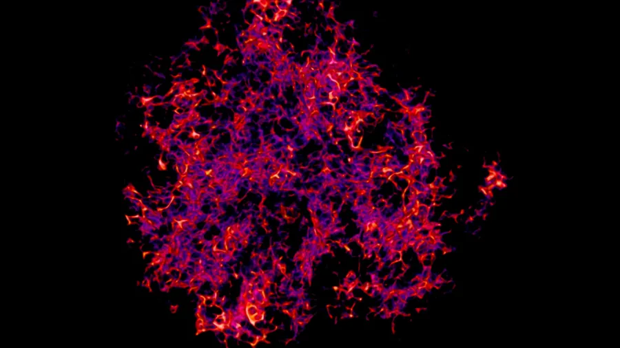 I'm very happy to share the work I've done in the Spits lab with you. The paper was published in the journal of experimental medicine.